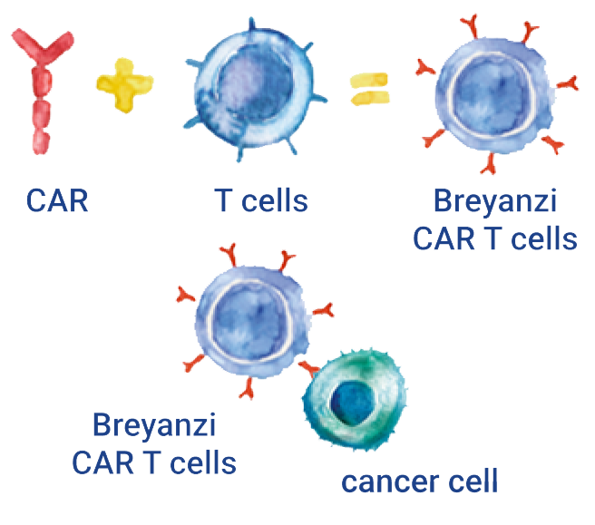 CAR plus T cells equals Breyanzi CAR T cell. Breyanzi CAR T cell and lymphoma cell.